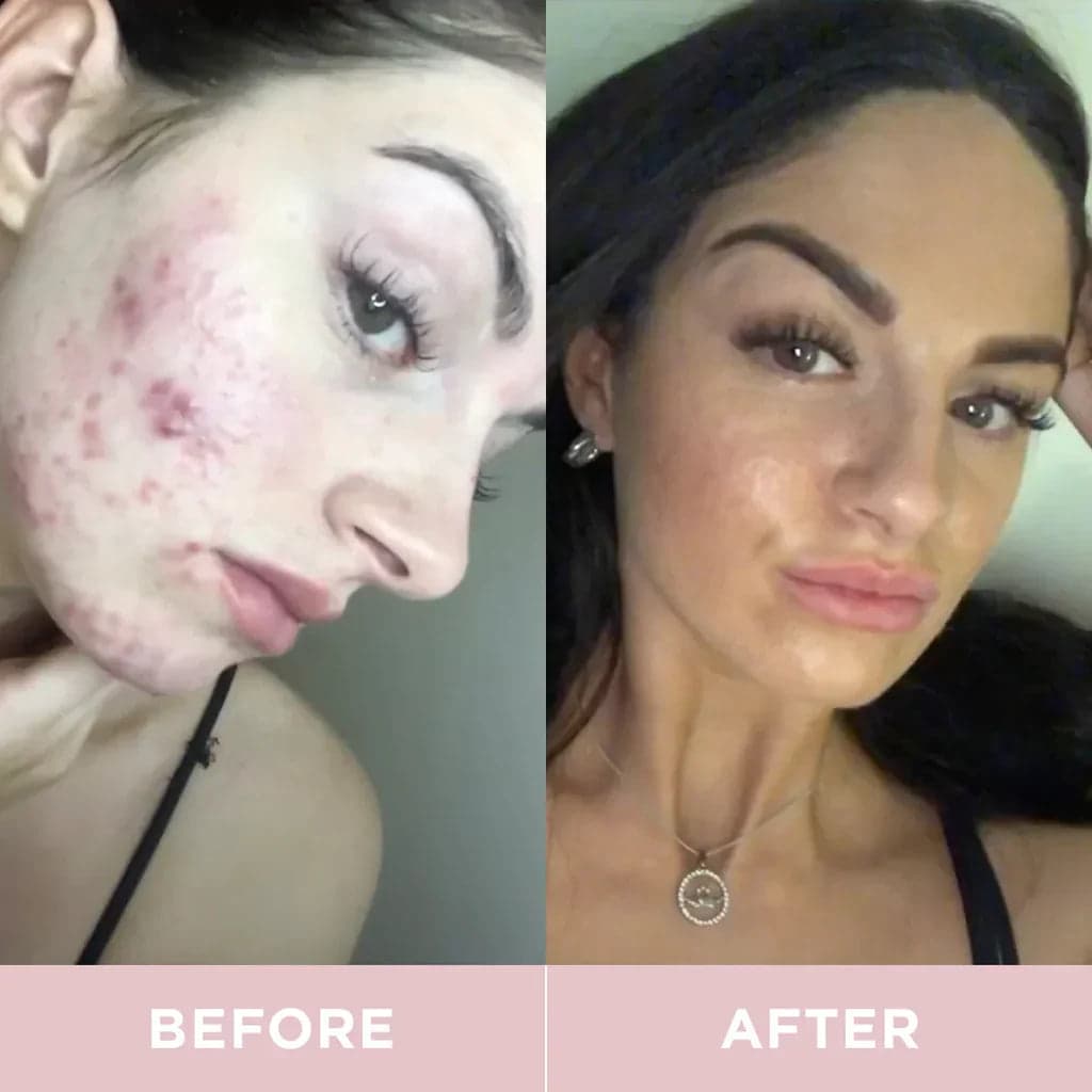 Limited Edition Beauty Crackers - Original